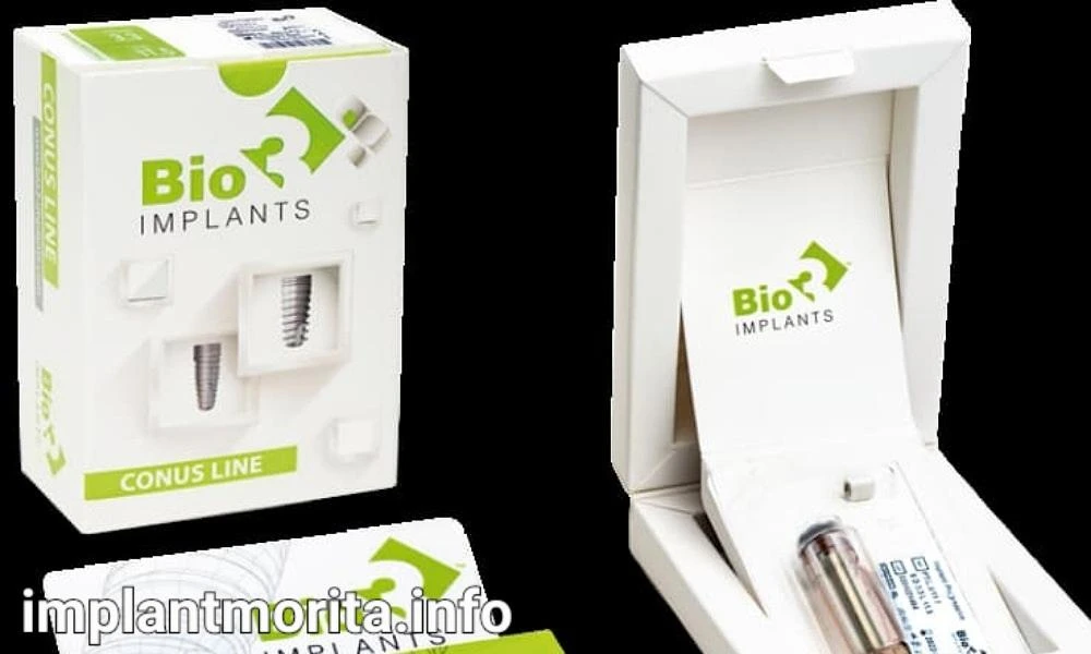 ایمپلنت آلمانی چیست