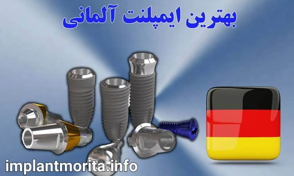 ایمپلنت آلمانی چیست