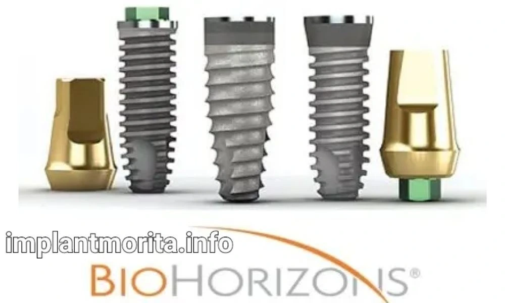 بهترین برند ایمپلنت دندان