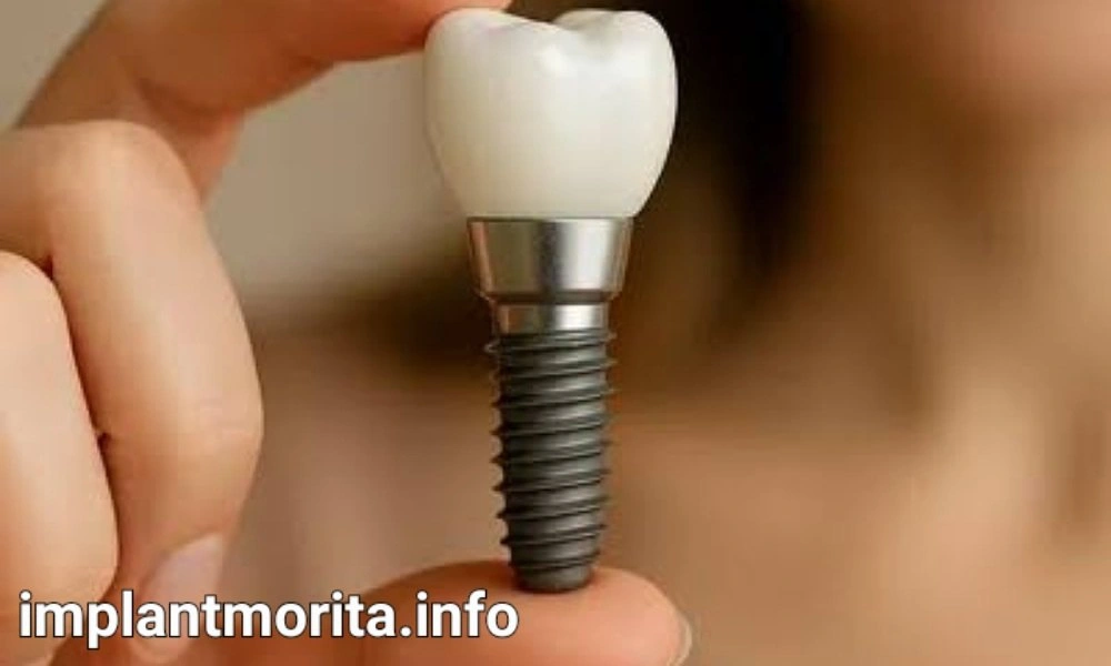 بهترین سن برای کاشت دندان