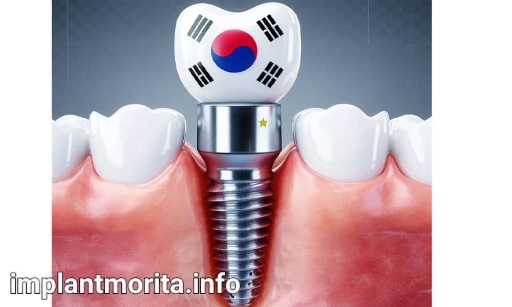 قیمت ایمپلنت کره‌ای