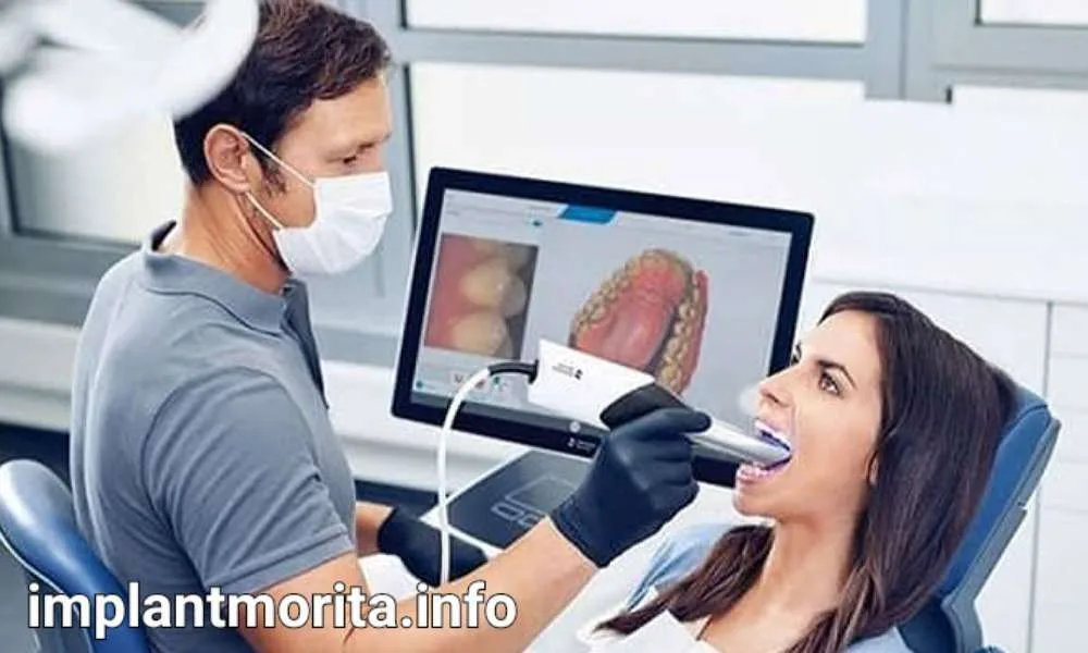 ایمپلنت دیجیتال چیست