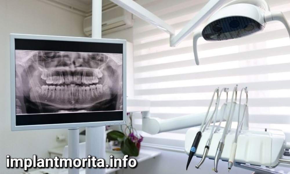 کلینیک معتبر ایمپلنت در ایران