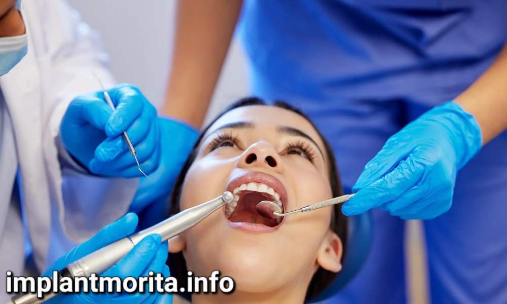 بهترین دندانپزشک برای ایمپلنت