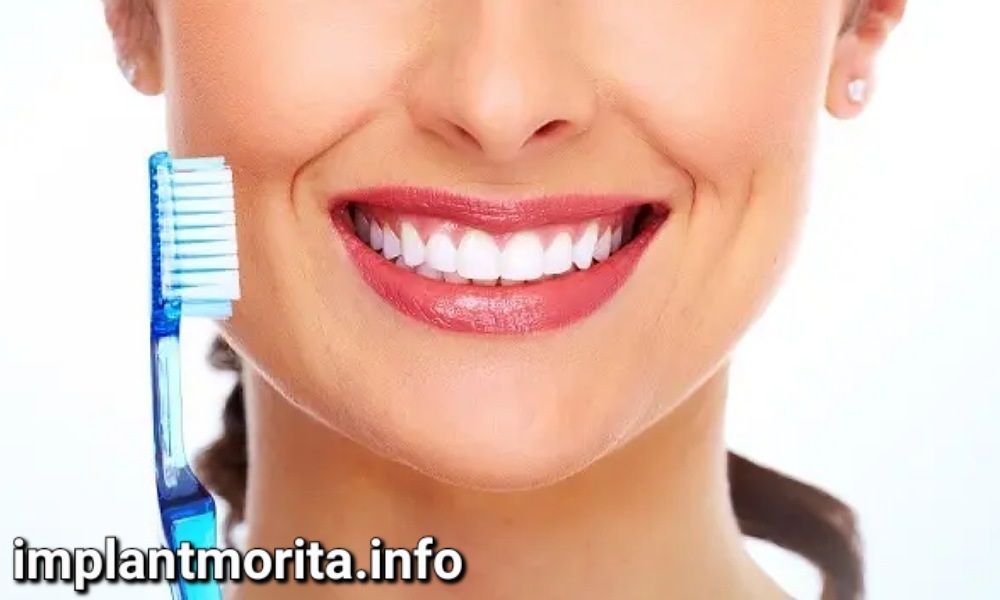 بعد از کاشت دندان چه مراقبت هایی لازم است