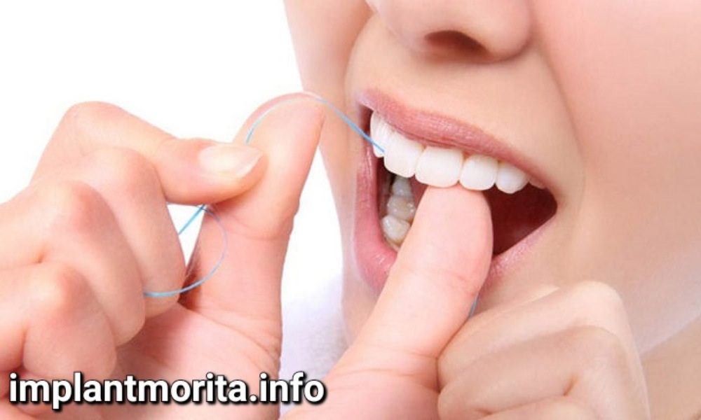 بعد از کاشت دندان چه مراقبت هایی لازم است