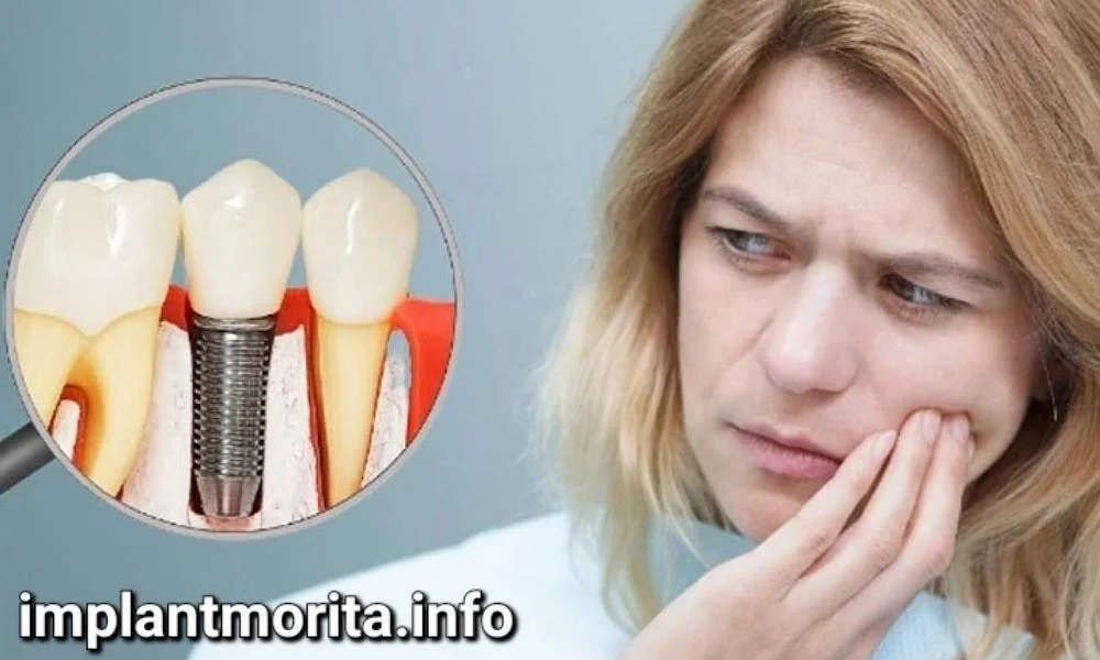 آیا ایمپلنت دندان درد دارد