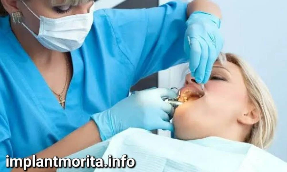 آیا ایمپلنت نیاز به تعویض دارد