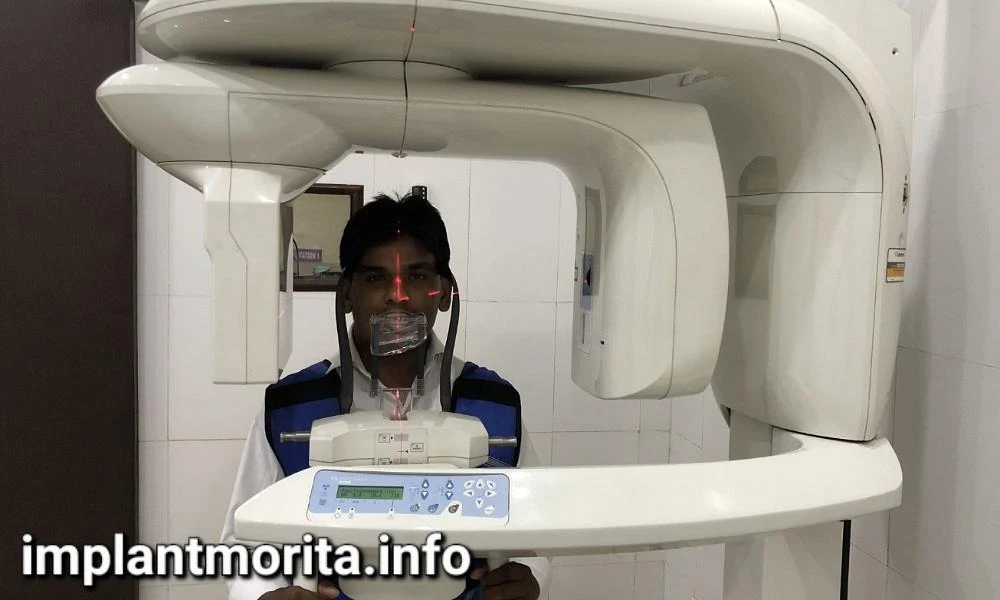اسکن سه بعدی CBCT