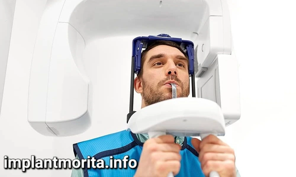 اسکن سه بعدی CBCT