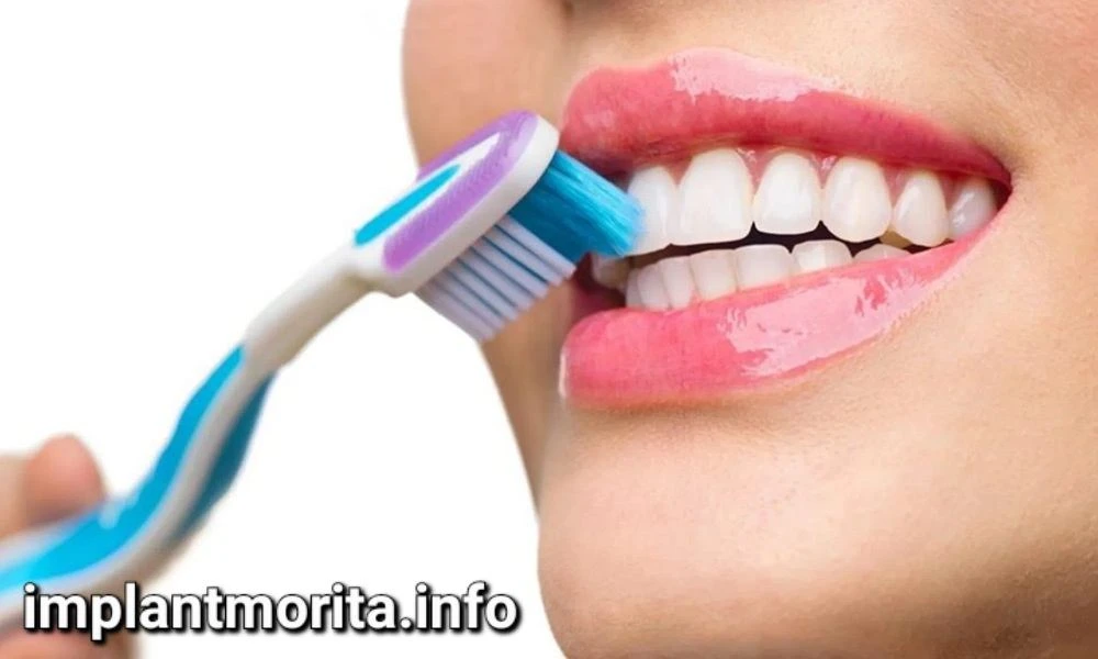 چگونه از ایمپلنت خود نگهداری کنیم